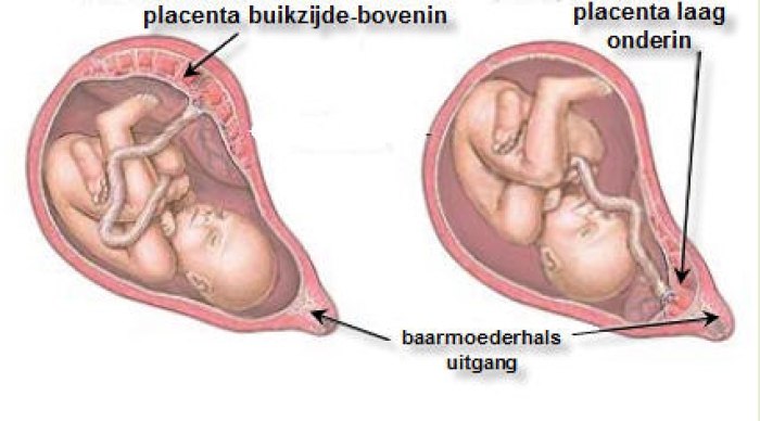 Ligging van de placenta